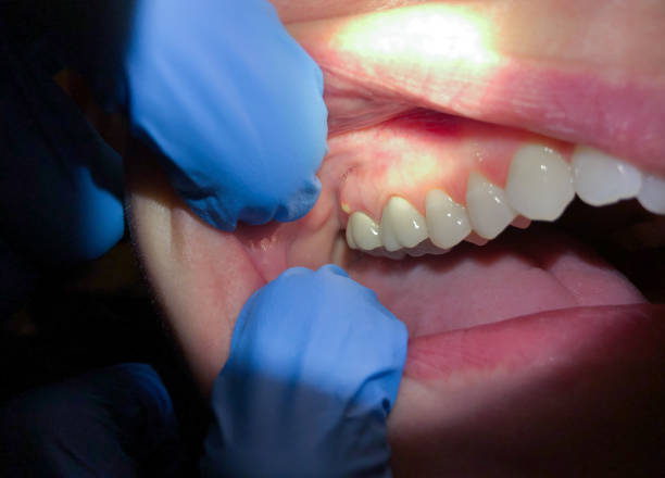 Best Orthodontic Emergency Dentist in Lansdowne, MD