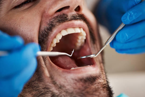 Best Pediatric Emergency Dentist in Lansdowne, MD